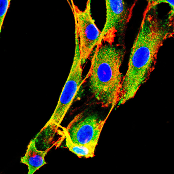 ASRGL1 Antibody