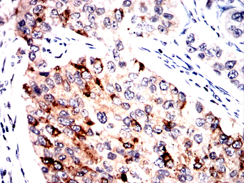 SPHK2 Antibody