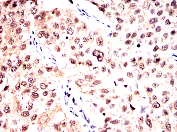 TEAD1 Antibody