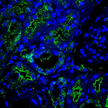 BMAL1 Antibody