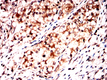 BMAL1 Antibody