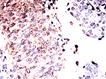 LAMC2 Antibody
