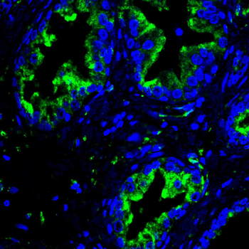 TUBB Antibody