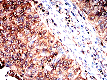 AKT1 Antibody