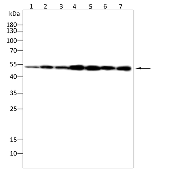 VIM Antibody