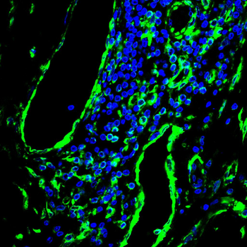 VIM Antibody