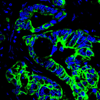 KRT18 Antibody