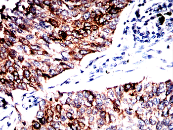 KRT18 Antibody