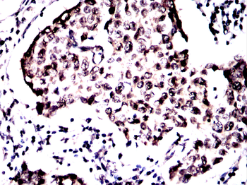 GSK3B Antibody