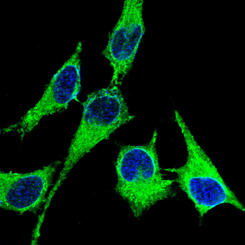 CDK5 Antibody