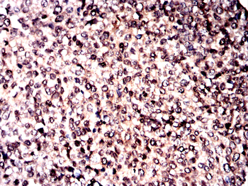 NFKB1 Antibody