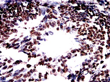 GSK3B Antibody