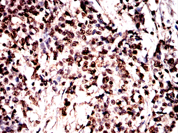 GSK3B Antibody