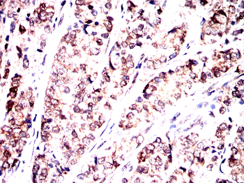 STAT3 Antibody