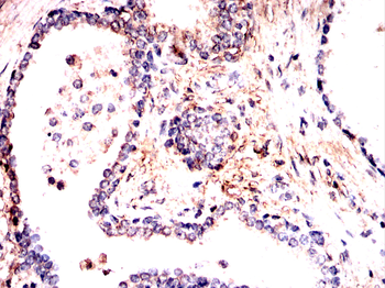 LRP1 Antibody