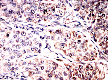 DCP1A Antibody