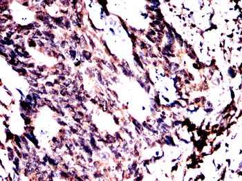 DCP1A Antibody