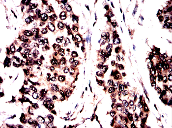 DCP1A Antibody