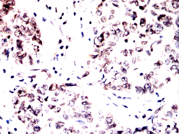 SYNE1 Antibody