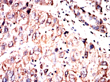 FDX1 Antibody