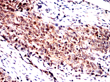 NOG Antibody
