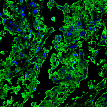 RPSA Antibody
