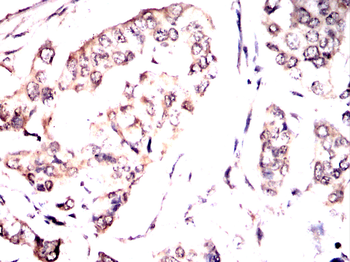 RPSA Antibody