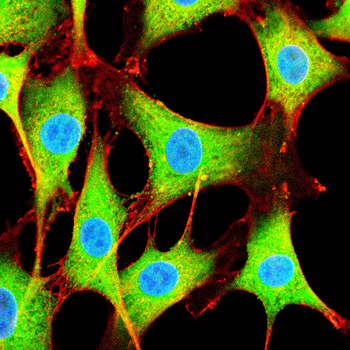 NCL Antibody