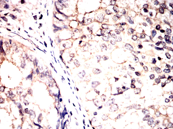 EIF2AK4 Antibody