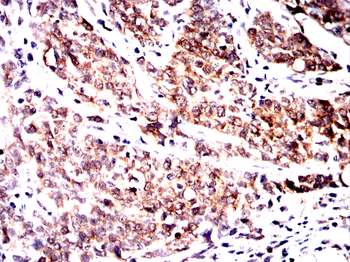 EIF2AK4 Antibody
