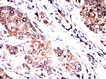 EIF2AK4 Antibody