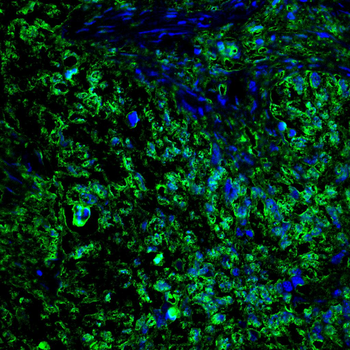EIF2AK4 Antibody
