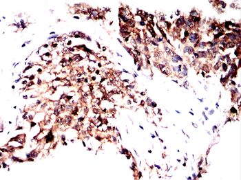 EIF2AK4 Antibody