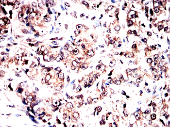 EIF2AK4 Antibody