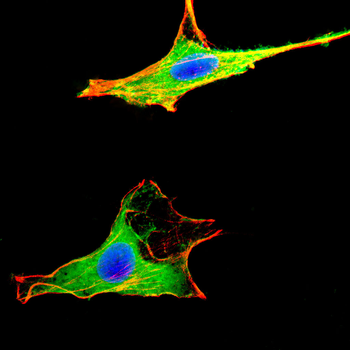 CCR8 Antibody
