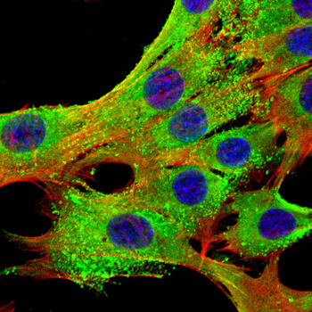 CTSB Antibody
