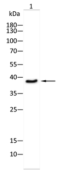 CTSB Antibody