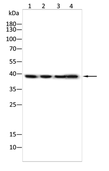 CTSB Antibody