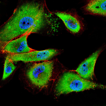 CTSB Antibody