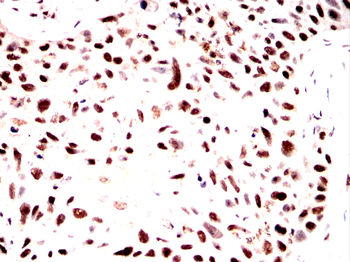 PTBP1 Antibody