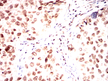 PTBP1 Antibody