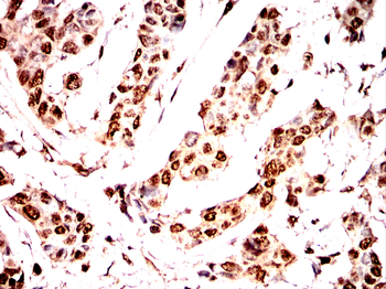 PTBP1 Antibody