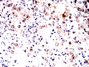 PTBP1 Antibody