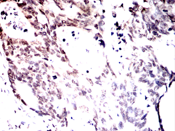 PTBP1 Antibody