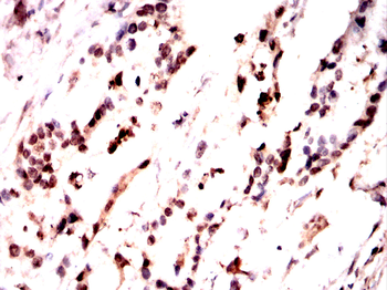 NCBP1 Antibody