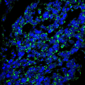STIM1 Antibody