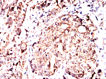 STIM1 Antibody
