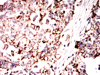 STIM1 Antibody