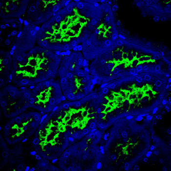KDM1A Antibody