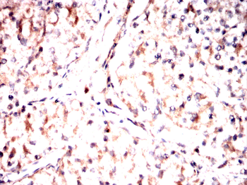KDM1A Antibody